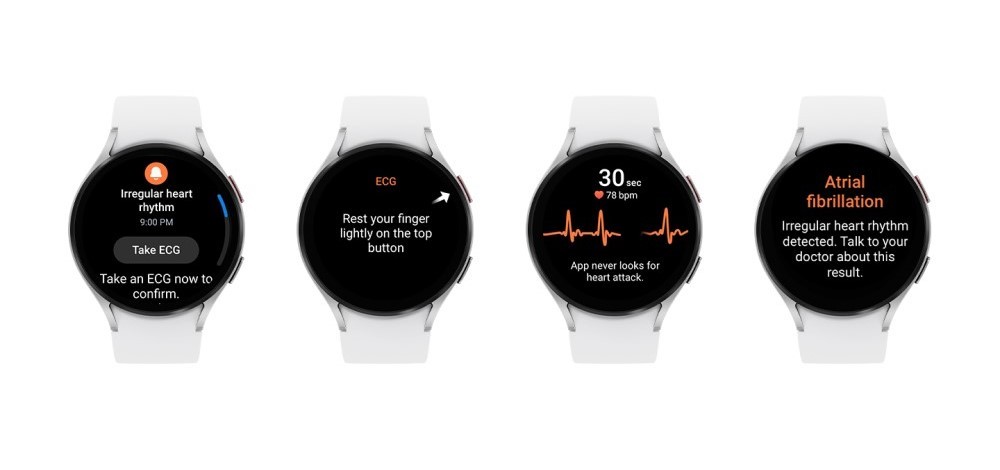 三星 Galaxy Watch 系列智能手表心律不齐通知功能今夏上线